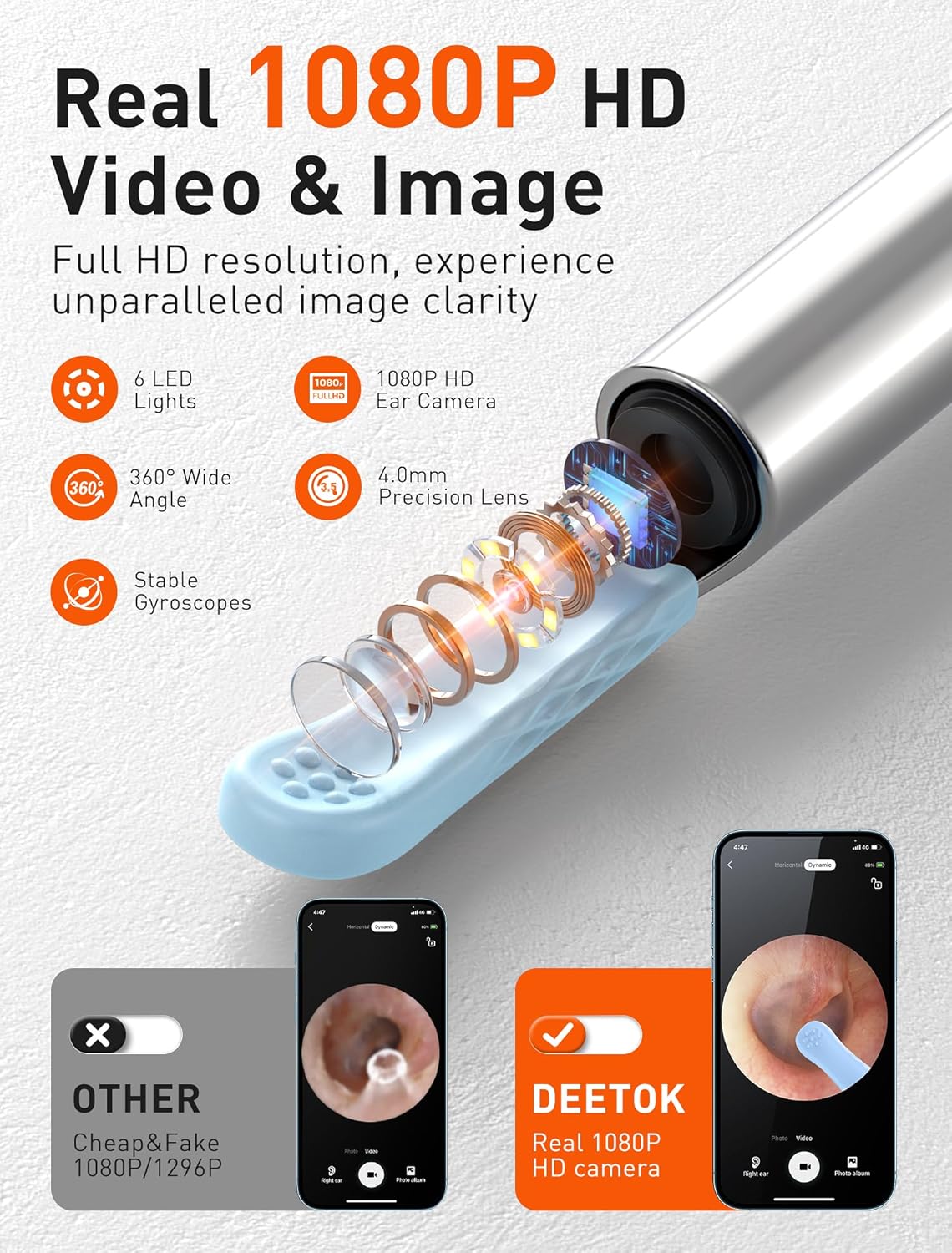 Auris Pro™ - High Precision Ear Cleaning Kit