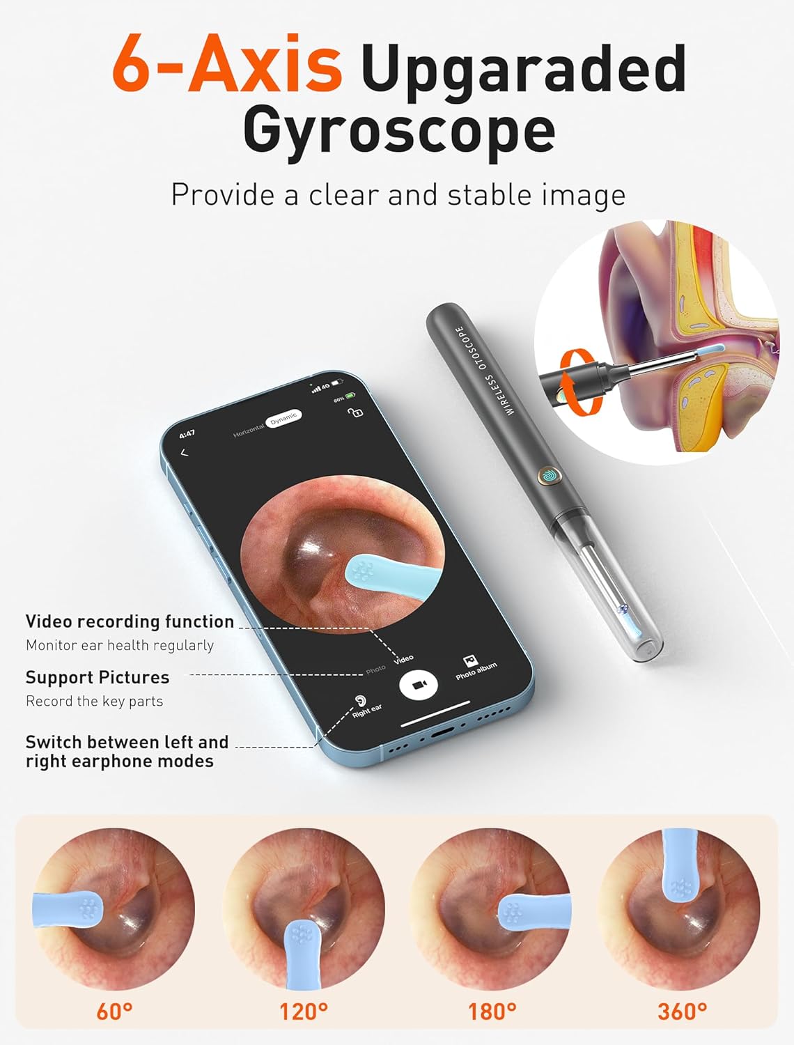 Auris Pro™ - High Precision Ear Cleaning Kit