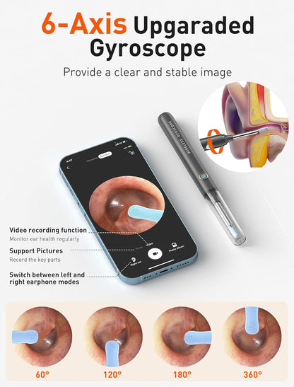 Auris Pro™ - High Precision Ear Cleaning Kit