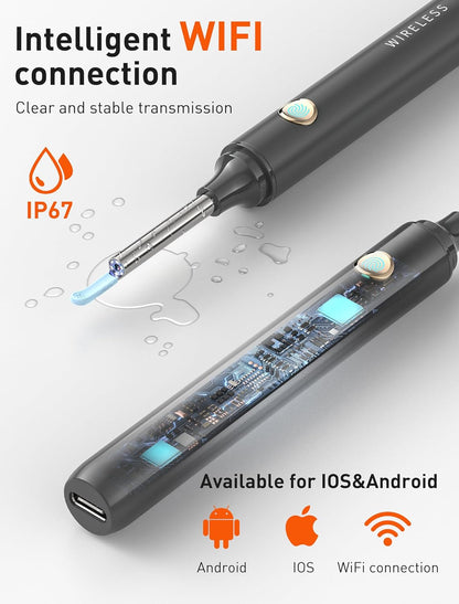 Auris Pro™ - High Precision Ear Cleaning Kit