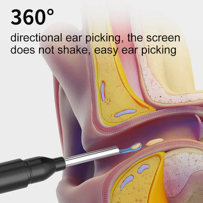 Auris Pro™ - High Precision Ear Cleaning Kit
