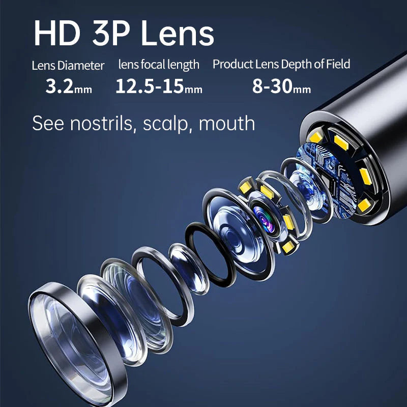 Auris Pro™ - High Precision Ear Cleaning Kit